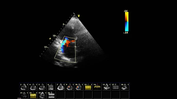 Transoesophageal Echocardiogram In Singapore | The Heart Practice Clinic